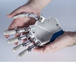 la prima 'mano bionica' sensibile agli oggetti è made in italy